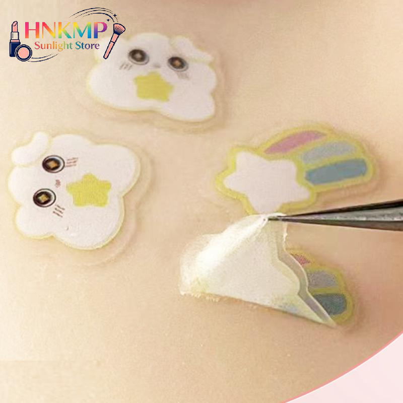 20pcs Cute Cloud Shaped  Treat - Skincare Acne 评论和价格